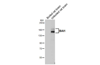 Anti-BAI1 antibody [HL4184] used in Western Blot (WB). GTX642998
