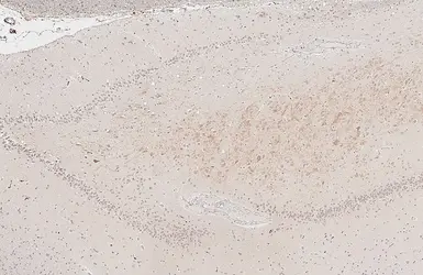 Anti-BDNF antibody [HL4205] used in IHC (Paraffin sections) (IHC-P). GTX643028