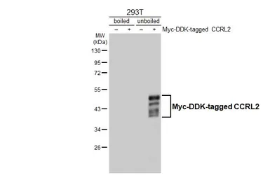 Anti-CCRL2 antibody [HL4222] used in Western Blot (WB). GTX643044