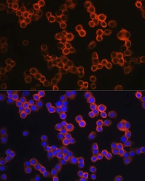 Anti-TLR4 antibody used in Immunocytochemistry/ Immunofluorescence (ICC/IF). GTX64330