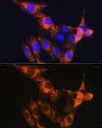 Anti-CD13 antibody used in Immunocytochemistry/ Immunofluorescence (ICC/IF). GTX64331