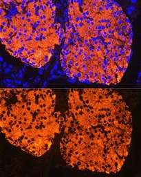 Anti-Insulin antibody used in IHC (Paraffin sections) (IHC-P). GTX64334