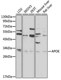 Anti-Apolipoprotein E antibody used in Western Blot (WB). GTX64352