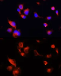 Anti-Apolipoprotein E antibody used in Immunocytochemistry/ Immunofluorescence (ICC/IF). GTX64352