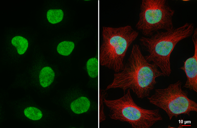 Anti-ERR alpha antibody [HL4307] used in Immunocytochemistry/ Immunofluorescence (ICC/IF). GTX643554