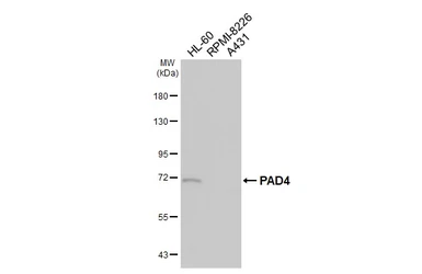 Anti-PAD4 antibody [HL4308] used in Western Blot (WB). GTX643555