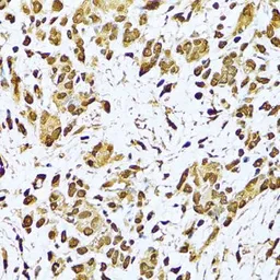 Anti-Ku70 antibody used in IHC (Paraffin sections) (IHC-P). GTX64359