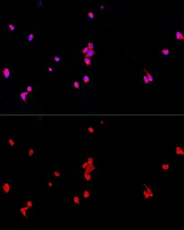 Anti-eIF2 alpha antibody used in Immunocytochemistry/ Immunofluorescence (ICC/IF). GTX64363