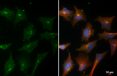 Anti-GALNT2 antibody [HL4377] used in Immunocytochemistry/ Immunofluorescence (ICC/IF). GTX643634