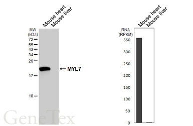 Anti-MYL7 antibody [HL4385] used in Western Blot (WB). GTX643642
