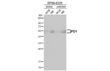 Anti-PD1 antibody [HL4386] used in Western Blot (WB). GTX643643