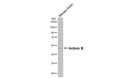 Anti-Inhibin beta B antibody [HL4390] used in Western Blot (WB). GTX643647