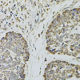 Anti-CD62P antibody used in IHC (Paraffin sections) (IHC-P). GTX64365