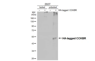 Anti-CCKBR antibody [HL4404] used in Western Blot (WB). GTX643661