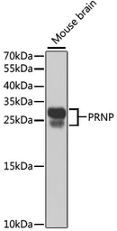 Anti-Prion Protein (PrP) antibody used in Western Blot (WB). GTX64378