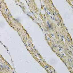 Anti-Prion Protein (PrP) antibody used in IHC (Paraffin sections) (IHC-P). GTX64378