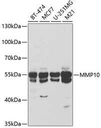 Anti-MMP10 antibody used in Western Blot (WB). GTX64385