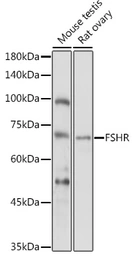 Anti-FSH Receptor antibody used in Western Blot (WB). GTX64391