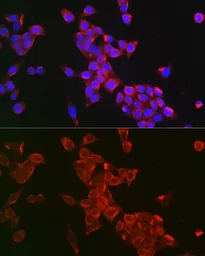 Anti-FSH Receptor antibody used in Immunocytochemistry/ Immunofluorescence (ICC/IF). GTX64391
