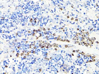 Anti-S100A9 antibody used in IHC (Paraffin sections) (IHC-P). GTX64397