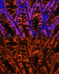 Anti-YB1 antibody used in IHC (Paraffin sections) (IHC-P). GTX64401