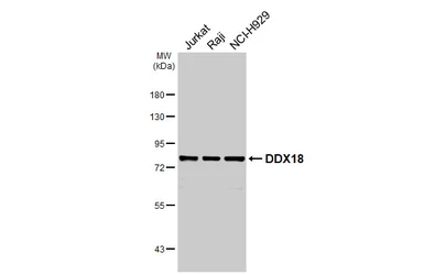 Anti-DDX18 antibody [HL4449] used in Western Blot (WB). GTX644014