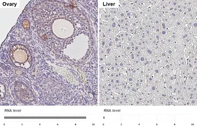 Anti-SLC38A1 antibody [HL4453] used in IHC (Paraffin sections) (IHC-P). GTX644018