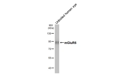 Anti-mGluR6 antibody [HL4469] used in Western Blot (WB). GTX644034