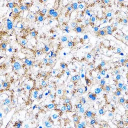 Anti-Cathepsin B antibody used in IHC (Paraffin sections) (IHC-P). GTX64404