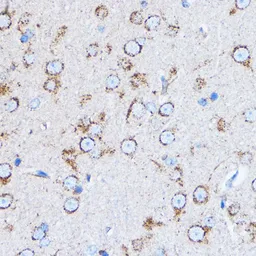 Anti-Cathepsin B antibody used in IHC (Paraffin sections) (IHC-P). GTX64404