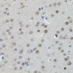 Anti-n-Myc antibody used in IHC (Paraffin sections) (IHC-P). GTX64413