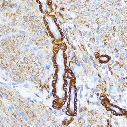Anti-MLCK antibody used in IHC (Paraffin sections) (IHC-P). GTX64416