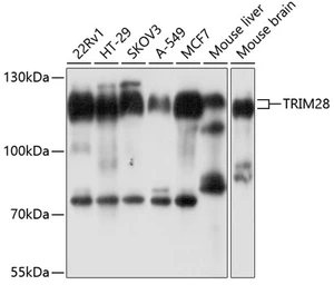 Anti-KAP1 antibody used in Western Blot (WB). GTX64422