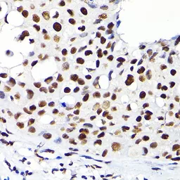 Anti-KAP1 antibody used in IHC (Paraffin sections) (IHC-P). GTX64422