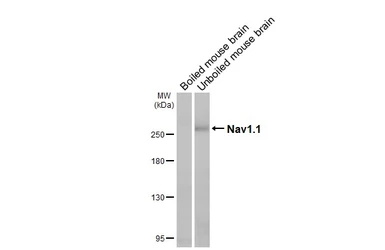 Anti-Nav1.1 antibody [GT230] used in Western Blot (WB). GTX644240