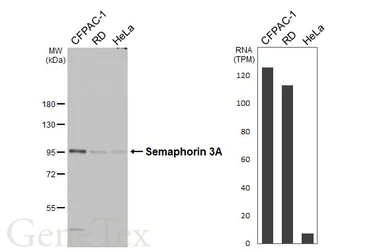 Anti-Semaphorin 3A antibody [HL4578] used in Western Blot (WB). GTX644254