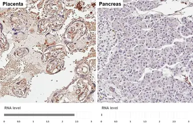 Anti-Semaphorin 3A antibody [HL4578] used in IHC (Paraffin sections) (IHC-P). GTX644254