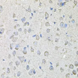 Anti-CD97 antibody used in IHC (Paraffin sections) (IHC-P). GTX64426
