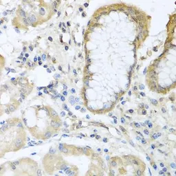 Anti-Eotaxin antibody used in IHC (Paraffin sections) (IHC-P). GTX64437
