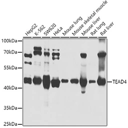 Anti-TEAD4 antibody used in Western Blot (WB). GTX64441