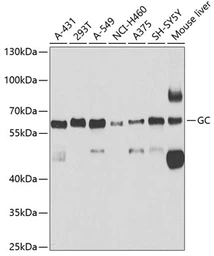 Anti-Vitamin D Binding Protein antibody used in Western Blot (WB). GTX64444