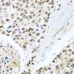 Anti-BNIP3L antibody used in IHC (Paraffin sections) (IHC-P). GTX64447
