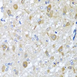 Anti-BNIP3L antibody used in IHC (Paraffin sections) (IHC-P). GTX64447