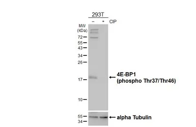 Anti-4E-BP1 (phospho Thr37/Thr46) antibody [HL4646] used in Western Blot (WB). GTX644519