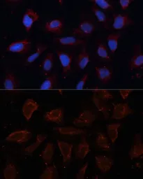 Anti-TMEM16A antibody used in Immunocytochemistry/ Immunofluorescence (ICC/IF). GTX64457