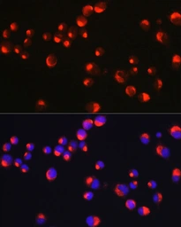 Anti-Peripherin antibody used in Immunocytochemistry/ Immunofluorescence (ICC/IF). GTX64462