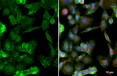 Anti-GIPR antibody [HL4762] used in Immunocytochemistry/ Immunofluorescence (ICC/IF). GTX644766