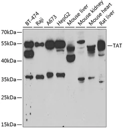 Anti-Tyrosine Aminotransferase antibody used in Western Blot (WB). GTX64477