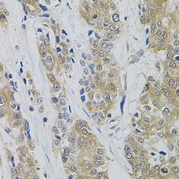 Anti-Dynamin 2 antibody used in IHC (Paraffin sections) (IHC-P). GTX64478