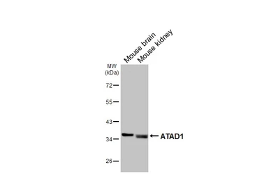 Anti-ATAD1 antibody [GT275] used in Western Blot (WB). GTX644790